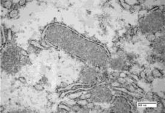 Sobrevivendo ao ambiente amazônico: mecanismos mitocondriais na determinação da tolerância à hipóxia